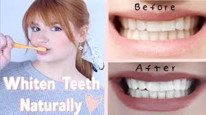 Here are some natural methods i used to learn how to whiten teeth naturally Whiten Teeth Naturally And Fast Without Damage Perfect For Sensitive Teeth Youtube