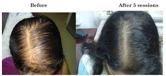Image result for what is a dc hair treatment