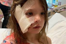 Steiner 5-year-old healing after being attacked by large dog