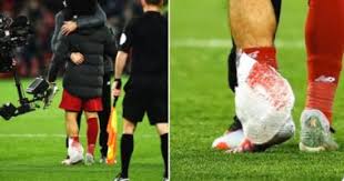 Yahya1 الأربعاء 27 سبتمبر 10:49. ÙÙÙØ±Ø¨ÙÙ Ø¶Ø¯ ÙØ§Ù Ø³ÙØªÙ ÙØ­ÙØ¯ ØµÙØ§Ø­ ÙÙÙÙ Ø¬ÙØ§ÙÙØ± Ø§ÙØ±ÙØ¯Ø² Ø¨Ø¹Ø¯ ÙØ¨Ø§Ø±Ø§Ø© Ø§ÙØ³ÙØªÙ ØµÙØ± Ø§ÙÙÙÙ Ø§ÙØ³Ø§Ø¨Ø¹