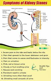 Symptoms Of Kidney Stones Htns29 Healthtipsandservice Tipsoftheday Healthtips Healthfacts Healthylife Kidney Health Kidney Stones Symptoms Health Facts