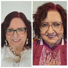 Why is my beard white