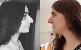 Zdjęcia kobiet z dużymi nosami