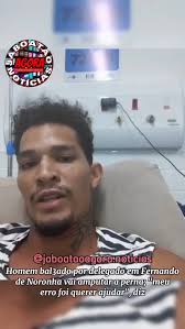#AMPUTAÇÃO, Vídeo que circula nas redes sociais, mostra o ambulante  Emmanuel Pedro Apory, de 26 anos, que foi bal3ado pelo delegado Luiz  Alberto Braga de Queiroz, após uma briga durante uma festa em ...