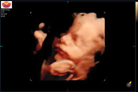 Hello. Thank you for allowing me to join this group. I was wondering if  someone would be able to help. Please could someone change my daughter's  dress from patterned material to a