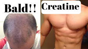 It causes hair follicle miniaturization over some time. Does The Popular Exercise Supplement Creatine Cause Hair Loss Hair Loss Treatments