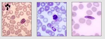 Malaria can occur if a mosquito infected with the plasmodium parasite bites you. Infectious Disease Vector Control Malaria Page 3