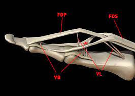 Test by asking patient to flex the wrist and palpate tendon/muscular contraction in summary, to test the extrinsic flexors: Flexor Tendon Injuries Radsource