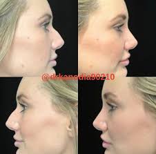 Reviews Dr. Raj Kanodia Medical Group (Plastic Surgery) in California