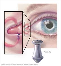 kuru goz tedavisi ankara prof dr yonca akova