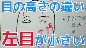 顔の左側全体的が下がって特に目の高さの違いが大きく左のほうが目も小さく見えて悩んでいます 目 大きく 顔