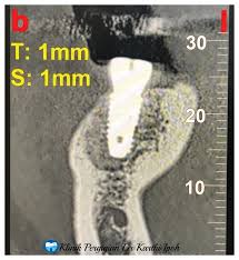 9 am to 5 pm this clinic accepts patient by : Klinik Pergigian Kerajaan Meru
