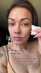 Best Witch Hazel to Use After Microblading