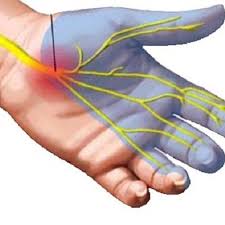 Image result for karp ln  tunel ort za