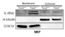 Interleukin-6 mediates PSAT1 expression and serine metabolism in ...