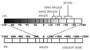 Hounsfield Unit Scale Download Scientific Diagram