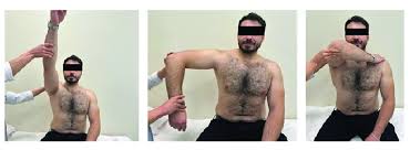 Image result for Hawkins Test