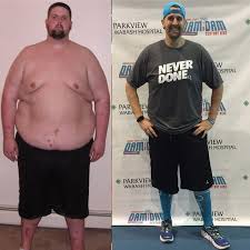 Pin On Before And After Weight Loss