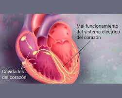 En algunas ocasiones hay que recurrir a métodos diagnósticos más complejos, como la mesa basculante o tilt test, un estudio electrofisiológico (para ver la actividad eléctrica del corazón) o incluso un cateterismo cardiaco. Diagnosticos Someec