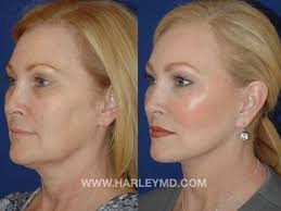 Biltmore Plastic Surgery