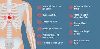 Sometimes a pain under the rib is nothing more than you slept wrong, or you exercised too hard, said dr. Getting To The Bottom Of Rib Cage Pain Nydnrehab Com