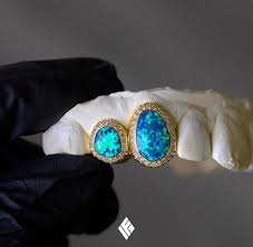 Opal Grill In 2020 Grillz Blue Opal Vs Diamond