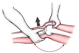 Image result for Lachman Test