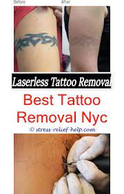 Can you get a tattoo while pregnant? Can You Get Tattoo Removal While Pregnant