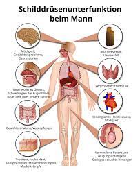 Das mittel wirkt präziser, weil der organismus selbst entscheidet, wann er auf das thyroxin zugreifen will. Welche Symptome Hat Die Schilddrusenunterfunktion Beim Mann