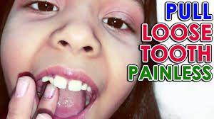 Causes of a loose tooth in an adult. How To Pull Loose Tooth Out Pulling Wobbly Tooth Painlessly At Home Youtube