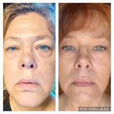 Can someone recommend a good eye cream. I have really dark circles under my  eyes. I need something that helps that and wrinkles and works with Seint  makeup.