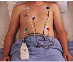 Lead Placement for Cardiac Monitoring