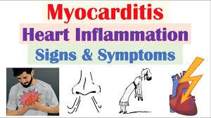 Image result for Myocarditis