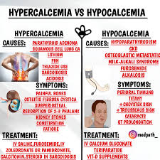 Image result for Hypercalcemia