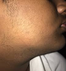 A poll asked 15 men in two age groups, 30 and younger and older than 30, whether they had facial hair (mustache, beard, sideburns, etc.). 15 Yo Beard Beard Board