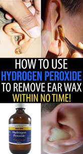 Your Ears Can Indicate Your Health Never Ignore These Earwax Clean Ear Wax Out Ear Cleaning Wax Ear Wax