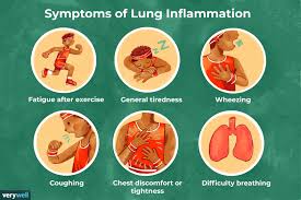 These types of heart inflammation can be caused by a variety of infections, including a bout of myocarditis is an inflammation of the heart muscle. Lung Inflammation Symptoms Causes Treatment More