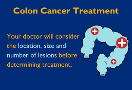 Let your doctor know if you have any of the following symptoms. Colon Cancer Treatment What To Know About Surgery Johns Hopkins Medicine