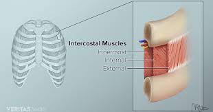 But if they stretch too far or tear, intercostal muscle strain is the end result. Upper Back Pain From Intercostal Muscle Strain