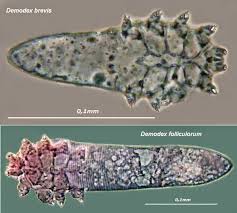 Image result for Demodex brevis