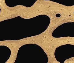 As shown in figure 2. Bone Cross Section Photograph By Science Photo Library