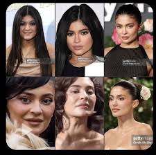 Kylie Jenners Facelift : rKUWTKsnark