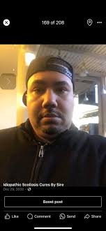 Idiopathic scoliosis: debunking myths and understanding connections