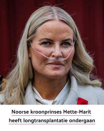 De operatie is goed gegaan, laat het Noorse hof weten. Wel moet de  kroonprinses meerdere weken in het ziekenhuis in Oslo blijven om te  herstellen. Dat is standaard na deze operatie. Mette-Marit