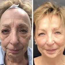 BEST of Kingwood, Houston, TX Skin Care