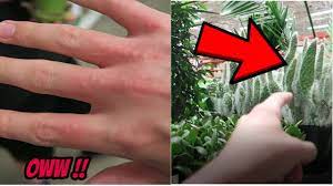 They annoy u to the point of wanting to take a cactus and stab them with it. Pricked By A Cactus Bad Reaction Youtube