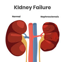 Image result for Renal Function