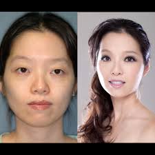 David S. Kung, MD, FACS (@kungplasticsurgery) · Chevy Chase, MD