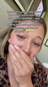 Stop stressing about your ingrown hairs! Come see me #charlottenc #bla...