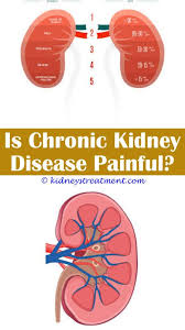 Kidney Problems Kidney Disease Awareness Kidney Disease Diet Kidney Infection Cure